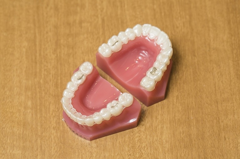 歯が移動する際の痛み